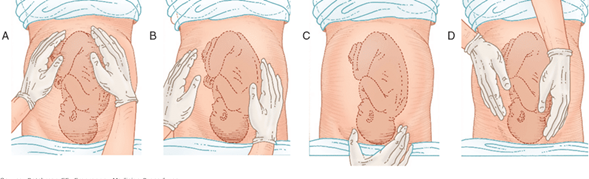 Procedimiento Maniobras de Leopold.